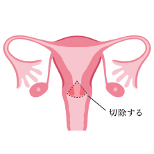 治療方法や予防方法は?