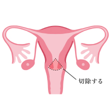 治療方法や予防方法は？